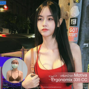 เสริมหน้าอก Mediprime Clinic แก้หน้าอก แผลเล็ก