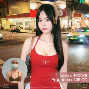 เสริมหน้าอก Mediprime Clinic แก้หน้าอก แผลเล็ก